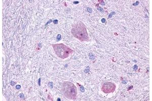 Anti-CHRM4 antibody  ABIN1048444 IHC staining of human brain, neurons and glia.