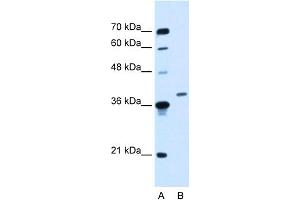 WB Suggested Anti-HOXD11 Antibody Titration:  0. (HOXD11 抗体  (Middle Region))