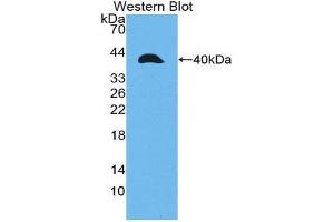 Western Blotting (WB) image for anti-Matrix Metalloproteinase 23A (MMP23A) (AA 71-383) antibody (ABIN1980456) (MMP23A 抗体  (AA 71-383))