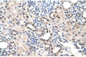 Human kidney (RORA 抗体  (Middle Region))