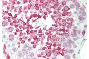 Rabbit Anti-BRD9 antibody  Formalin Fixed Paraffin Embedded Tissue: Human Testis Primary antibody Concentration: 1:100 Secondary Antibody: Donkey anti-Rabbit-Cy3 Secondary Antibody Concentration: 1:200 Magnification: 20x Exposure Time: 0. (BRD9 抗体  (N-Term))