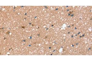 Immunohistochemistry of paraffin-embedded Human brain using STX2 Polyclonal Antibody at dilution of 1:40 (STX2 抗体)