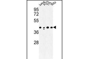 Western blot analysis of CANT1 Antibody (N-term) (ABIN652769 and ABIN2842506) in Jurkat, , Y79, WiDr cell line lysates (35 μg/lane). (CANT1 抗体  (N-Term))