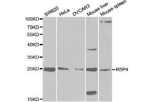 Western blot analysis of extracts of various cell lines, using RBP4 antibody. (RBP4 抗体  (AA 19-201))