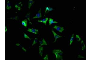 Immunofluorescence staining of SH-SY5Y cells with ABIN7170227 at 1:166, counter-stained with DAPI. (SLC35D3 抗体  (AA 304-416))