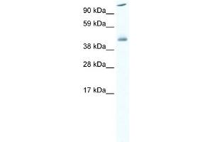 WB Suggested Anti-HSF1 Antibody Titration:  0. (HSF1 抗体  (C-Term))
