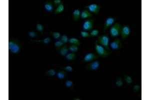 Immunofluorescence staining of Hela cells with ABIN7157376 at 1:133, counter-stained with DAPI. (KRT12 抗体  (AA 1-178))