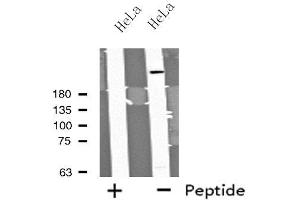 Western blot analysis of extracts from HeLa cells using MYO9B antibody. (MYO9B 抗体  (N-Term))