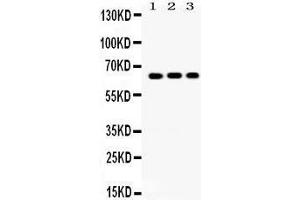 Western Blotting (WB) image for anti-Cryptochrome 1 (Photolyase-Like) (CRY1) (AA 153-189), (N-Term) antibody (ABIN3042761) (CRY1 抗体  (N-Term))
