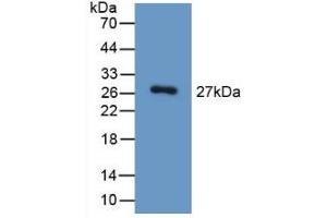 Detection of Recombinant HGD, Mouse using Polyclonal Antibody to Homogentisate-1,2-Dioxygenase (HGD) (HGD 抗体  (AA 190-429))