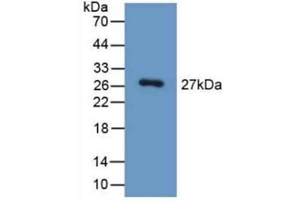 HGD 抗体  (AA 190-429)