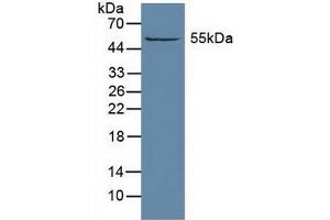 Figure. (ALDH1A1 抗体  (AA 2-501))