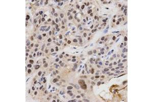 Immunohistochemistry (Paraffin-embedded Sections) (IHC (p)) image for anti-Karyopherin (Importin) alpha 4 (KPNA4) (AA 1-240) antibody (ABIN3015855)