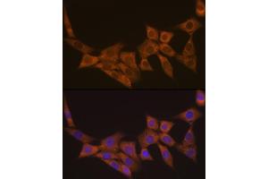 Immunofluorescence analysis of NIH-3T3 cells using DCP1A Rabbit mAb (ABIN7266678) at dilution of 1:100 (40x lens). (DCP1A 抗体)