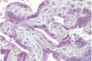 Immunohistochemistry with Placenta tissue at an antibody concentration of 5µg/ml using anti-IRF6 antibody (ARP31995_P050) (IRF6 抗体  (Middle Region))