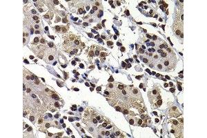 Immunohistochemistry of paraffin-embedded Human stomach using DNAJB6 Polyclonal Antibody at dilution of 1:100 (40x lens). (DNAJB6 抗体)