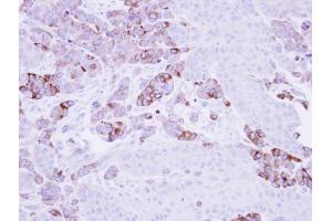 IHC-P Image Immunohistochemical analysis of paraffin-embedded SG xenograft, using Epoxide hydrolase 1, antibody at 1:500 dilution. (EPHX1 抗体)