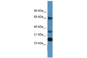 WB Suggested Anti-CANX Antibody Titration: 0. (Calnexin 抗体  (C-Term))