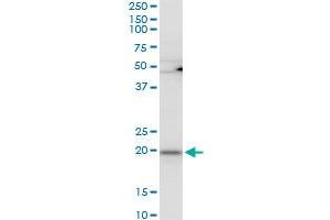 RPL21 polyclonal antibody (A01), Lot # 051220JC01. (RPL21 抗体  (AA 2-85))
