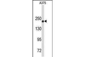 Western blot analysis of TOP2A Antibody in A375 cell line lysates (35ug/lane) (Topoisomerase II alpha 抗体  (C-Term))