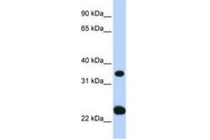 Image no. 1 for anti-Solute Carrier Family 25, Member 35 (SLC25A35) (N-Term) antibody (ABIN6740860)