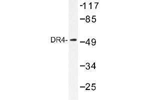 Image no. 1 for anti-Tumor Necrosis Factor Receptor Superfamily, Member 10a (TNFRSF10A) antibody (ABIN272303) (TNFRSF10A 抗体)