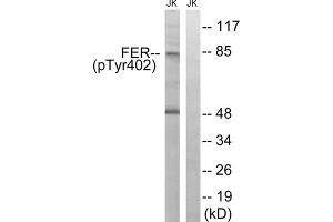 Western blot analysis of extracts from Jurkat cells, treated with starved (24hours), using FER (Phospho-Tyr402) antibody. (FER 抗体  (pTyr402))