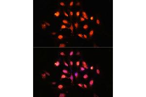 Immunofluorescence (IF) image for anti-PH Domain and Leucine Rich Repeat Protein Phosphatase 1 (PHLPP1) (AA 1508-1717) antibody (ABIN6145573)
