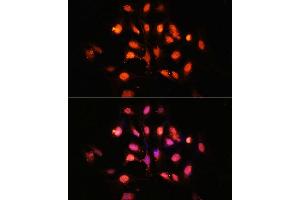 Immunofluorescence analysis of U-2 OS cells using PHLPP1 Polyclonal Antibody (ABIN6128434, ABIN6145573, ABIN6145574 and ABIN6225035) at dilution of 1:100 (40x lens). (PHLPP1 抗体  (AA 1508-1717))