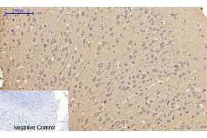 Immunohistochemical analysis of paraffin-embedded rat brain tissue. (Caveolin-1 抗体  (AA 100-180))
