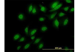 Immunofluorescence of monoclonal antibody to NEK3 on HeLa cell. (NEK3 抗体  (AA 406-506))