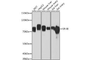 Western blot analysis of extracts of various cell lines, using SR-BI Rabbit mAb (ABIN7270156) at 1:1000 dilution. (SCARB1 抗体)