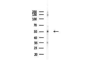 anti-Septin 6 (SEPT6) (Internal Region) antibody