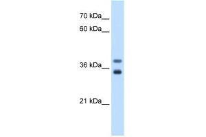 WB Suggested Anti-GDE1 Antibody Titration:  0. (GDE1 抗体  (N-Term))