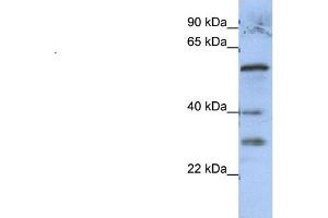 WB Suggested Anti-GADL1  Antibody Titration: 0. (GADL1 抗体  (Middle Region))