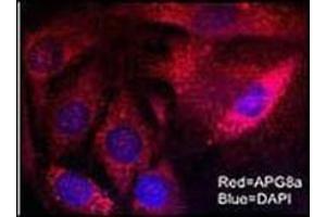Immunofluorescence (IF) image for anti-Microtubule-Associated Protein 1 Light Chain 3 alpha (MAP1LC3A) (AA 1-30), (N-Term) antibody (ABIN1449594)