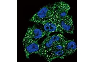 Immunofluorescence (IF) image for anti-Non-Metastatic Cells 1, Protein (NM23A) Expressed in (NME1) (AA 25-54), (N-Term) antibody (ABIN392655)