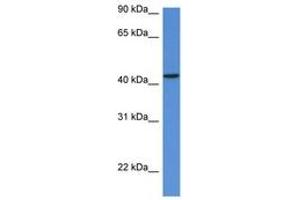 Image no. 1 for anti-Mevalonate (Diphospho) Decarboxylase (MVD) (AA 74-123) antibody (ABIN6746938) (MVD 抗体  (AA 74-123))