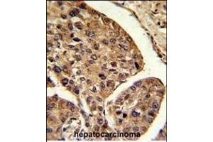 Immunohistochemistry (Paraffin-embedded Sections) (IHC (p)) image for anti-Proteasome (Prosome, Macropain) Activator Subunit 2 (PA28 Beta) (PSME2) (AA 61-91) antibody (ABIN390646)
