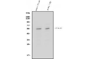 Western blot analysis of IFN Gamma Receptor Beta/AF-1/Ifngr2 using anti-IFN Gamma Receptor Beta/AF-1/Ifngr2 antibody (ABIN7600544).