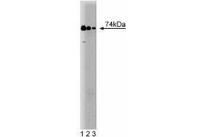 Western blot analysis of RIP on a human endothelial cell lysate. (RIPK1 抗体  (AA 385-650))