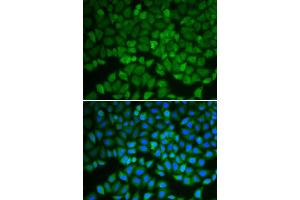 Immunofluorescence analysis of A549 cell using GSS antibody. (Glutathione Synthetase 抗体)