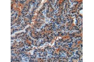 Immunohistochemistry (IHC) image for anti-Relaxin/insulin-Like Family Peptide Receptor 1 (RXFP1) (AA 260-409) antibody (ABIN7438106)
