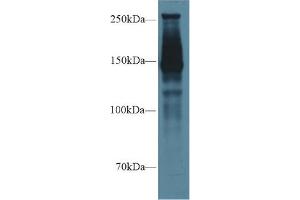 Western Blot; Sample: Rat Lung lysate; Primary Ab: 1µg/ml Rabbit Anti-Rat SPTAN1 Antibody Second Ab: 0. (SPTAN1 抗体  (AA 1004-1181))