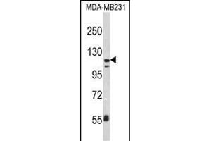 Western blot analysis of ITGAX Antibody (C-term) (ABIN390974 and ABIN2841153) in MDA-M cell line lysates (35 μg/lane). (CD11c 抗体  (C-Term))