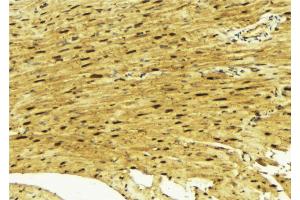 ABIN6269312 at 1/100 staining Mouse muscle tissue by IHC-P. (MEF2A 抗体  (Internal Region))