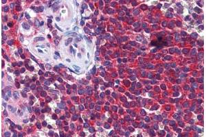 Human Spleen: Formalin-Fixed, Paraffin-Embedded (FFPE) (STIP1 抗体  (AA 445-544))