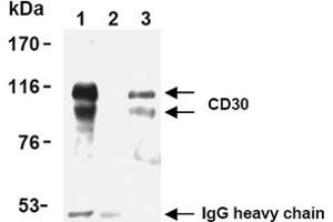 Western Blotting (WB) image for anti-Tumor Necrosis Factor Receptor Superfamily, Member 8 (TNFRSF8) antibody (ABIN492585)