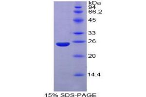 SDS-PAGE analysis of Mouse Nucleoporin 160 kDa Protein. (NUP160 蛋白)