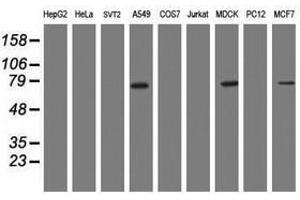 Image no. 2 for anti-Receptor (TNFRSF)-Interacting serine-threonine Kinase 1 (RIPK1) (AA 133-422) antibody (ABIN1490913) (RIPK1 抗体  (AA 133-422))